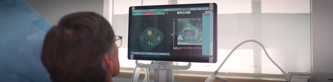 Biopsia Prostática por Fusión: Innovación para detectar cánceres a tiempo