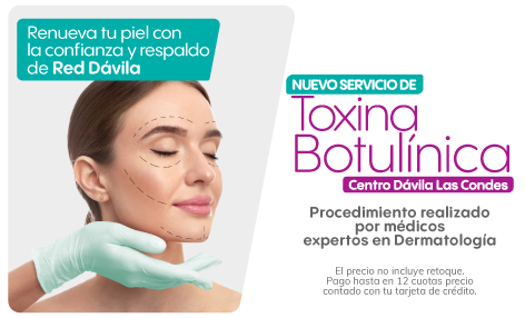 Toxina Botulínica en Centro Dávila Las Condes